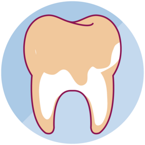 Blanqueamiento Dental