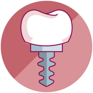 Implantes Dentales